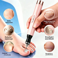 💅✨ Elektryczna pilnik do paznokci na grzybicę – przywróć zdrowy wygląd paznokci w domu 🦶