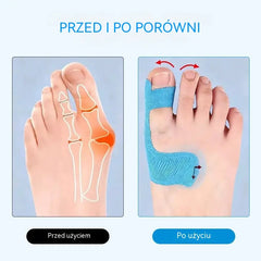 🔥 -50% TYLKO DZISIAJ!🔥[50 szt.] Elastyczne ochraniacze na palce, plastry na oparzenia, wytrzymałe bandaże sportowe