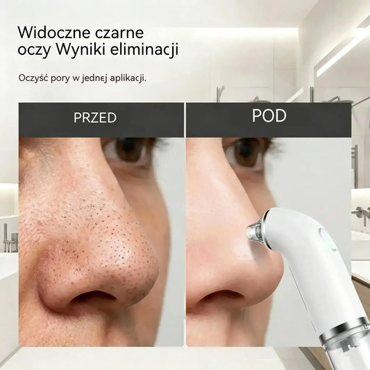 🔥 PROMOCJA! Elektryczny oczyszczacz do twarzy💆‍♀️Głębokie oczyszczanie porów · Efekt jędrniejszej i gładszej skóry ✨ Zadbaj o cerę w domu i oszczędź na salonie!